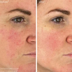 Youth-Boost Peptide