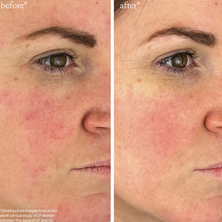 Youth-Boost Peptide